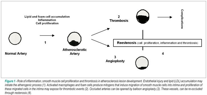 Experimental atherosclerosis in rabbits