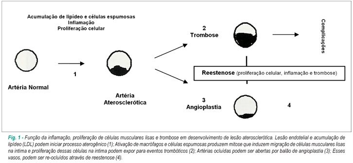 Aterosclerose experimental em coelhos