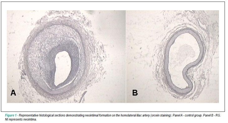 Rosiglitazone and vascular injury in hypercholesterolemic rabbits: neointimal formation assessment