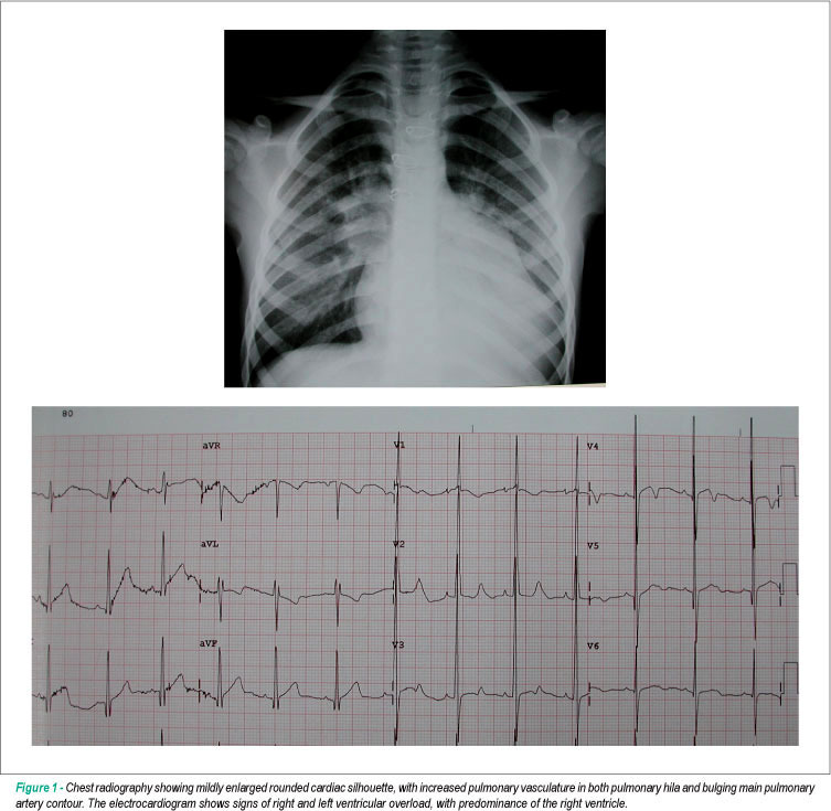 Case 5/2010 - A seven-year-old girl with tetralogy of fallot and absent pulmonary valve
