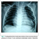 Imagem 1 da galeria