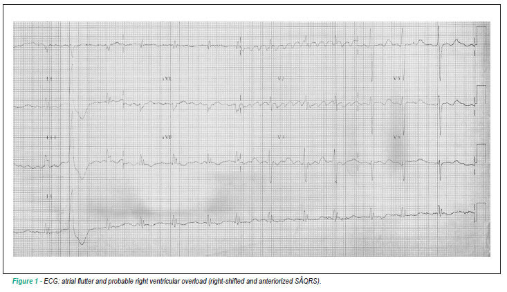 Case 5/2010: a 41 year-old man with myocardial hypertrophy who evolved with congestive heart failure
