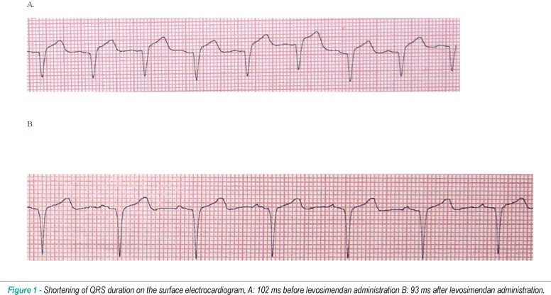 Acute effects of levosimendan and dobutamine on QRS duration in patients with heart failure