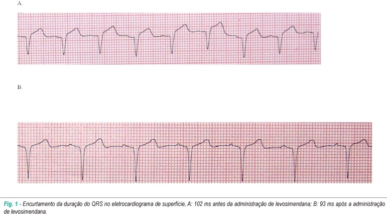 Efeitos agudos de levosimendana e dobutamina na duração do QRS em Pacientes com insuficiência cardíaca