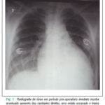 Imagem 1 da galeria