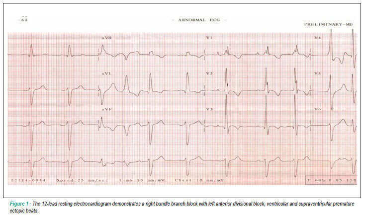 Long distance runner with dilated cardiomyopathy and excellent performance