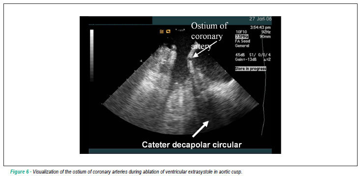 Gallery image 6