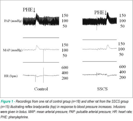 Sidestream cigarette smoke exposure effects on baroreflex in adult rats