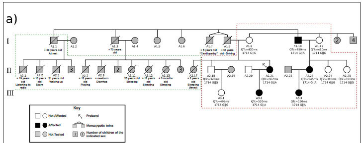 Investigation of ion channel gene variants in patients with long QT syndrome