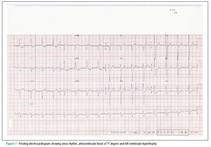 Heyde's syndrome: case report and literature review
