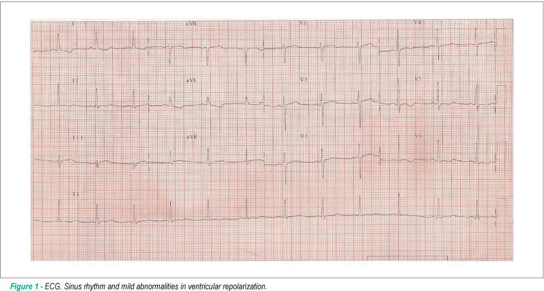 Case 2/2011 - Young patient, male, with pleuritic chest pain, hypotension, profuse sweating, with ECG with no acute ischemic abnormalities and negative myocardial injury markers