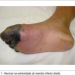 Imagem 1 da galeria