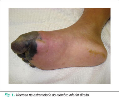 Imagem 1 da galeria