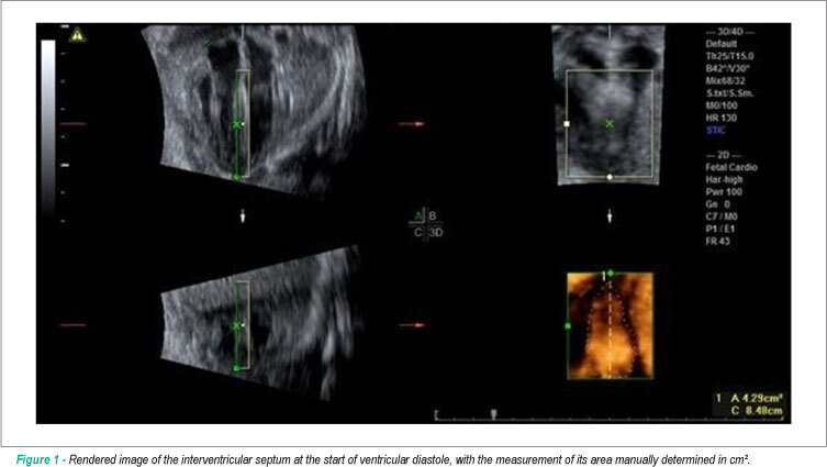 Reference curve of the fetal ventricular septum area by the STIC method: preliminary study