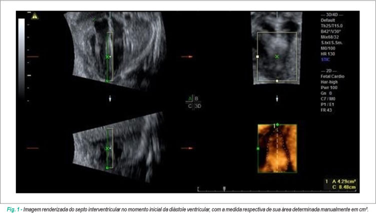 Curva de referência da área do septo interventricular fetal pelo método STIC: estudo preliminar