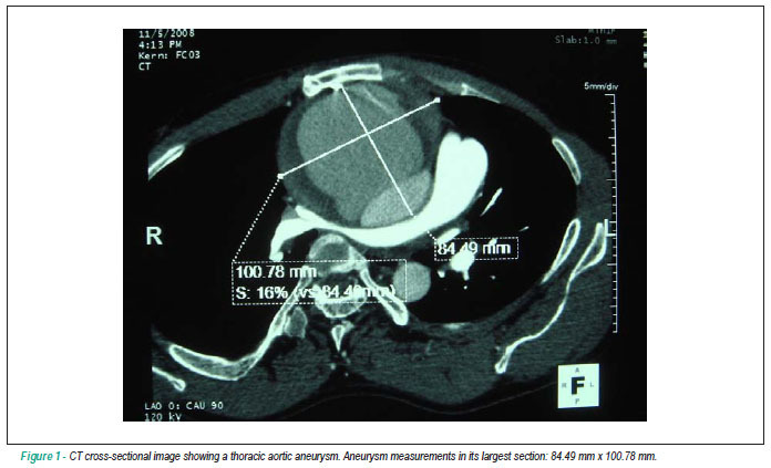 Transient positional dyspnea