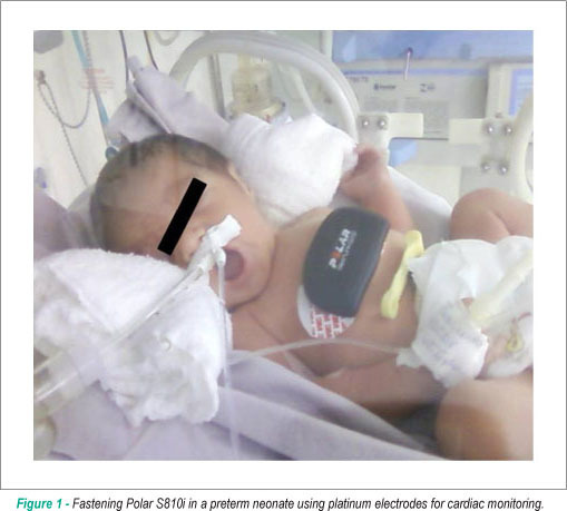 Heart rate variability in preterm and term neonates