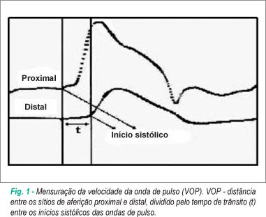 A velocidade da onda de pulso em jovens: estudo do Rio de Janeiro