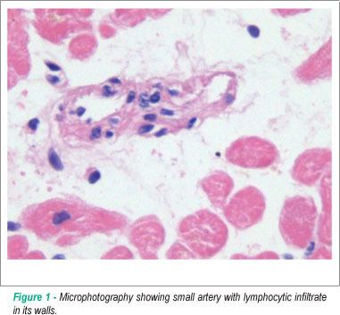 Vasculitides and eosinophils in emdomyocardial biopsies as rejection predictors in heart transplantation