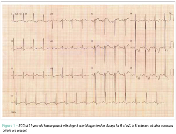 Electrocardiogram sensitivity in left ventricular hypertrophy according to gender and cardiac mass