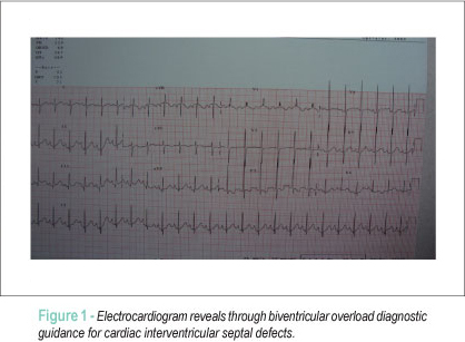 Case 5/2011 - Infant of 17 months of age with tetralogy of fallot in open heart failure due to hemodynamic dominance of the ventricular septal defect
