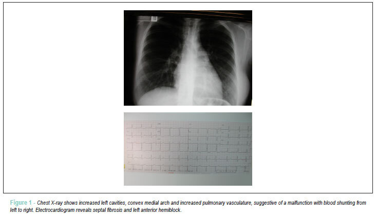 Case 6/2011 - 27-year-old woman with anomalous origin of left coronary artery from the pulmonary trunk
