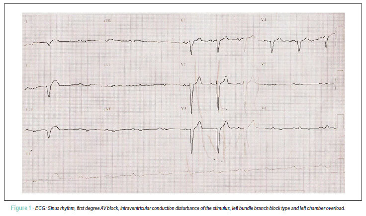 Case 6 / 2011: decompensated heart failure in man of 65 years of age, suffering from cardiomyopathy of chagas disease and coronary artery disease