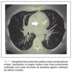 Imagem 1 da galeria
