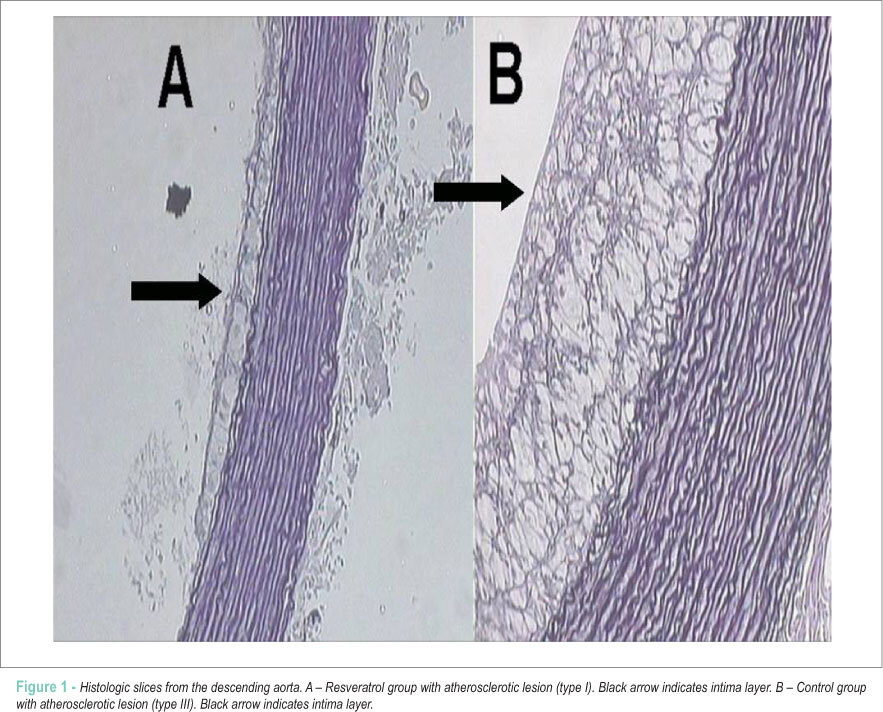Resveratrol causes antiatherogenic effects in an animal model of atherosclerosis