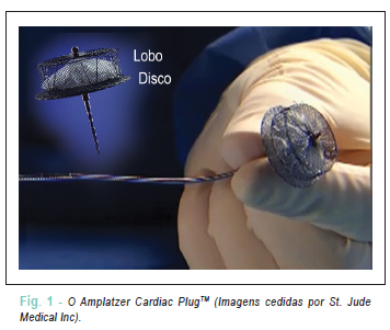 Oclusão percutânea do apêndice atrial esquerdo com o Amplatzer Cardiac PlugTM na fibrilação atrial