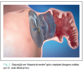 Imagem 2 da galeria