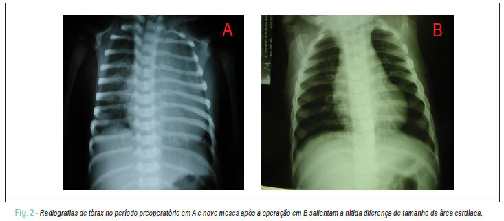 Imagem 2 da galeria