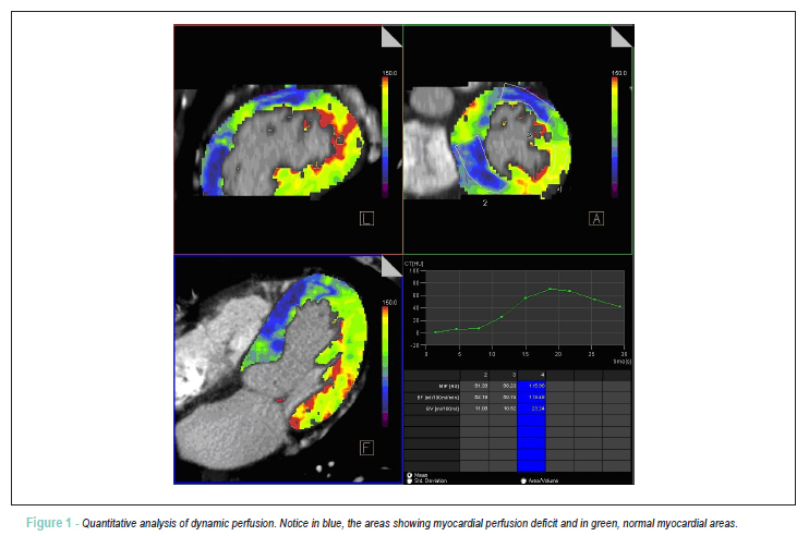 Dynamic myocardial perfusion imaging by dual-source computed tomography