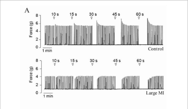 Myocardial remodeling after large infarcts in rat converts post rest-potentiation in force decay