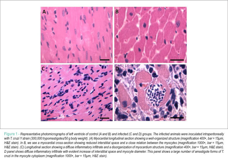 Use of fluorescence in a modified disector method to estimate the number of myocytes in cardiac tissue