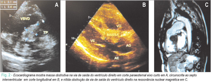 Imagem 2 da galeria