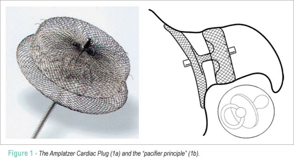 Left atrial appendage closure with the Amplatzer Cardiac Plug in patients with atrial fibrillation