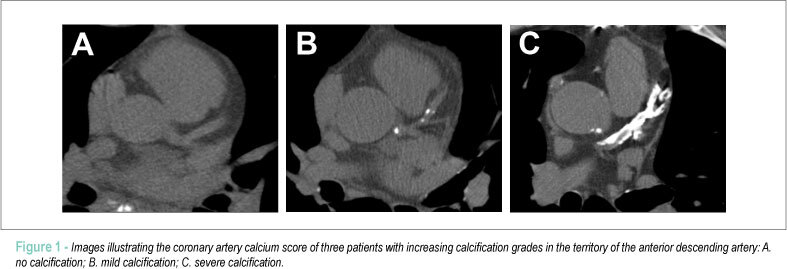 Coronary artery calcium score and coronary computed tomographic angiography for cardiovascular risk stratification