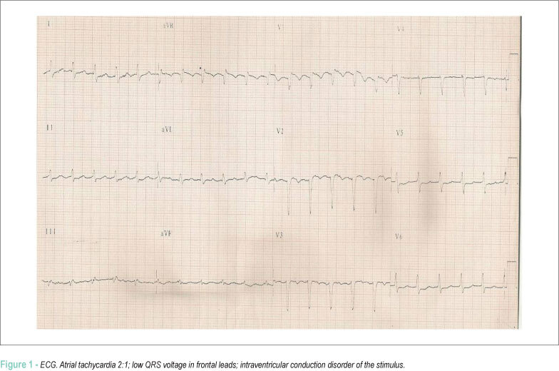 Case 2 – for index purposes: a 50 year old and past heavy drinker man admitted to treat decompensated heart failure