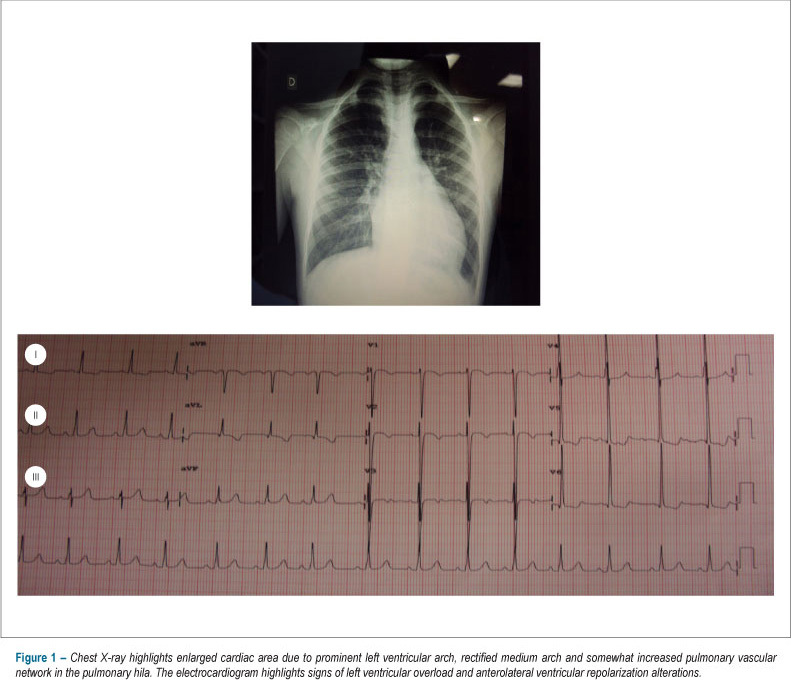 Case 5/2012: six-year-old child with anomalous origin of left coronary artery and mitral regurgitation