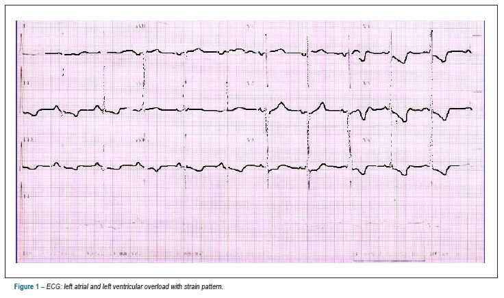 Case 03/12: a 41-year-old female patient with hypertrophic cardiomyopathy and congestive heart failure