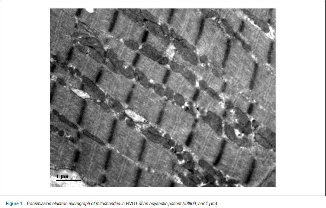 eNOS correlates with mitochondrial biogenesis in hearts of congenital heart disease with cyanosis