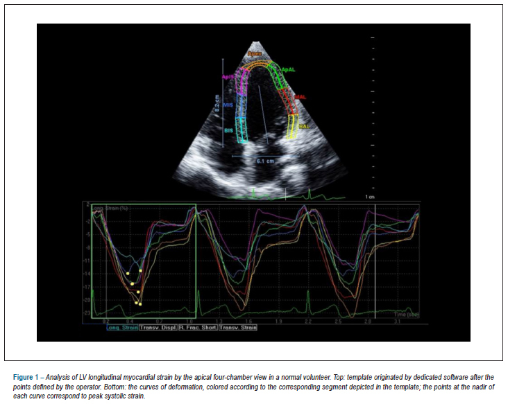 Myocardial deformation by speckle tracking in severe dilated cardiomyopathy