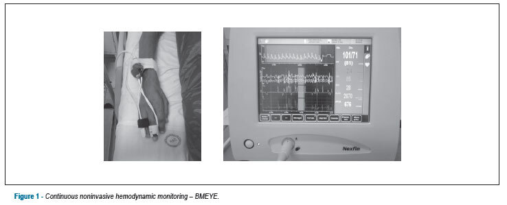Continuous noninvasive hemodynamic monitoring in decompensated heart failure