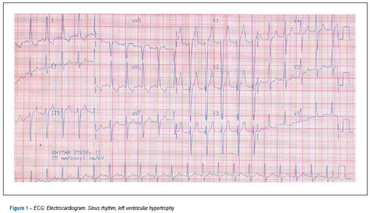 Case 04/12: a 44-year-old male with rheumatic valvular heart disease with multiple previous surgeries of aortic valve replacement admitted for treatment of congestive heart failure