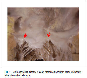 Imagem 4 da galeria