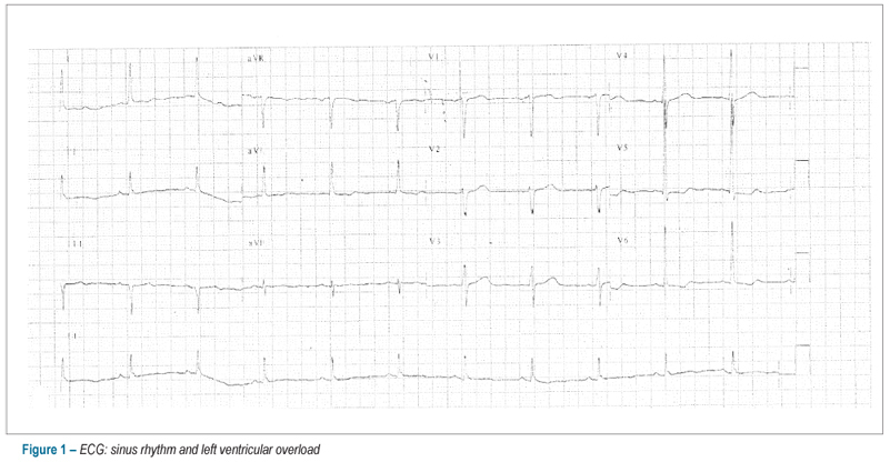Case 05/12: a 67 year-old hypertensive woman with atrial fibrillation who presented shock followed by cardiac arrest with pulseless electric activity two months after surgical repair of ascending aorta aneurysm