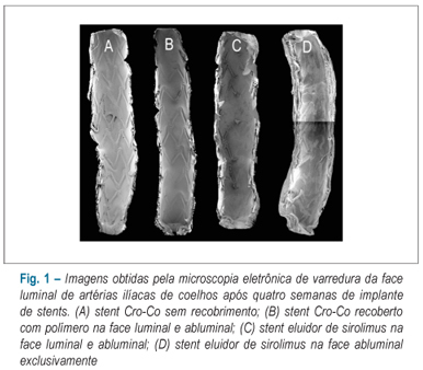 Avaliação da endotelização de hastes de stents em artérias ilíacas de coelhos