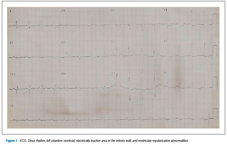 Case 6: late cardiogenic shock after myocardial infarction in a 50 year-old hypertensive and diabetic man