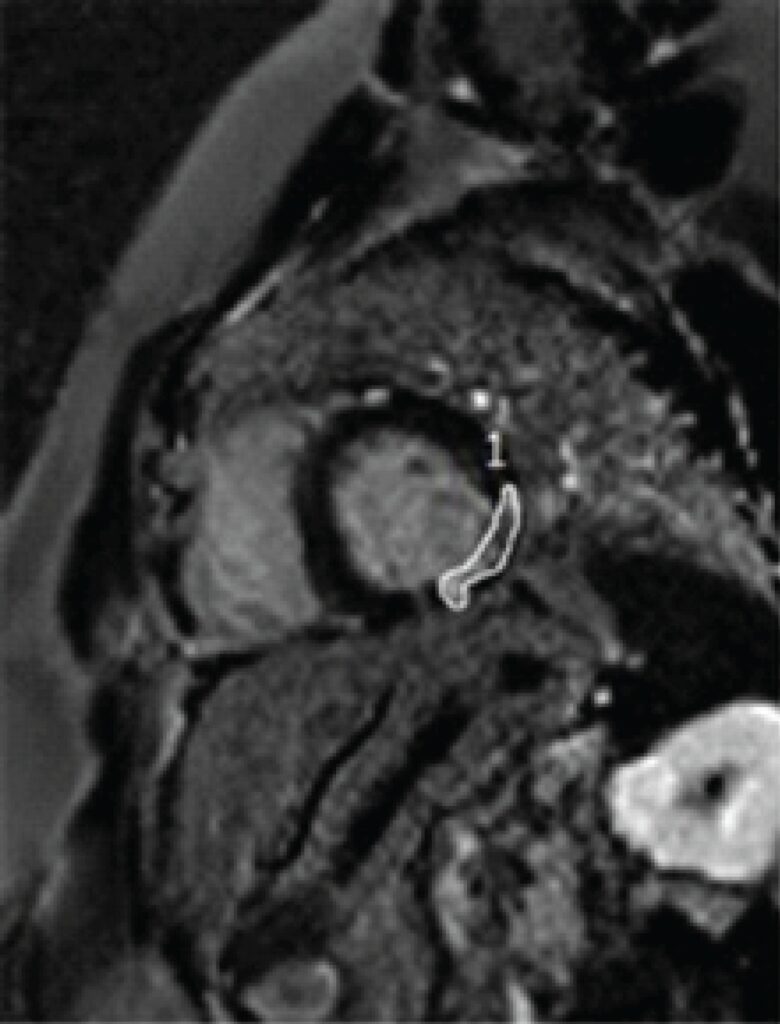 Figura 2